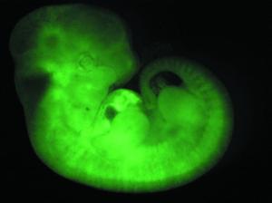 Fluorescenční mikroskopie
