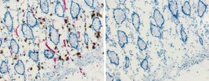 Jak specificky zacílit: blokátory v imunohistochemii