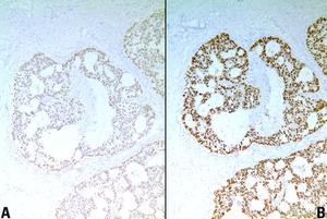 Vliv fixace a zpracování tkání na imunohistochemii