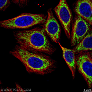 Pohled dovnitř buněk pomocí barvení: Barvení organel