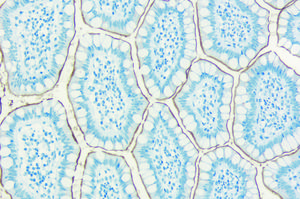 Jednoduchý průvodce výběrem substrátů pro imunohistochemii od společnosti Vector Laboratories