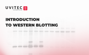 Úvod do Western blottingu – 1. díl odborné série webinářů