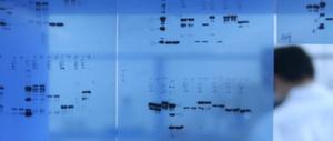 Průvodce řešením problémů – Western blot